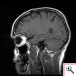 370098_mri_head_scan